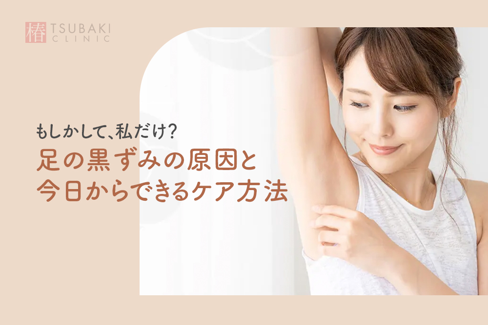 もしかして、私だけ？足の黒ずみの原因と今日からできるケア方法
