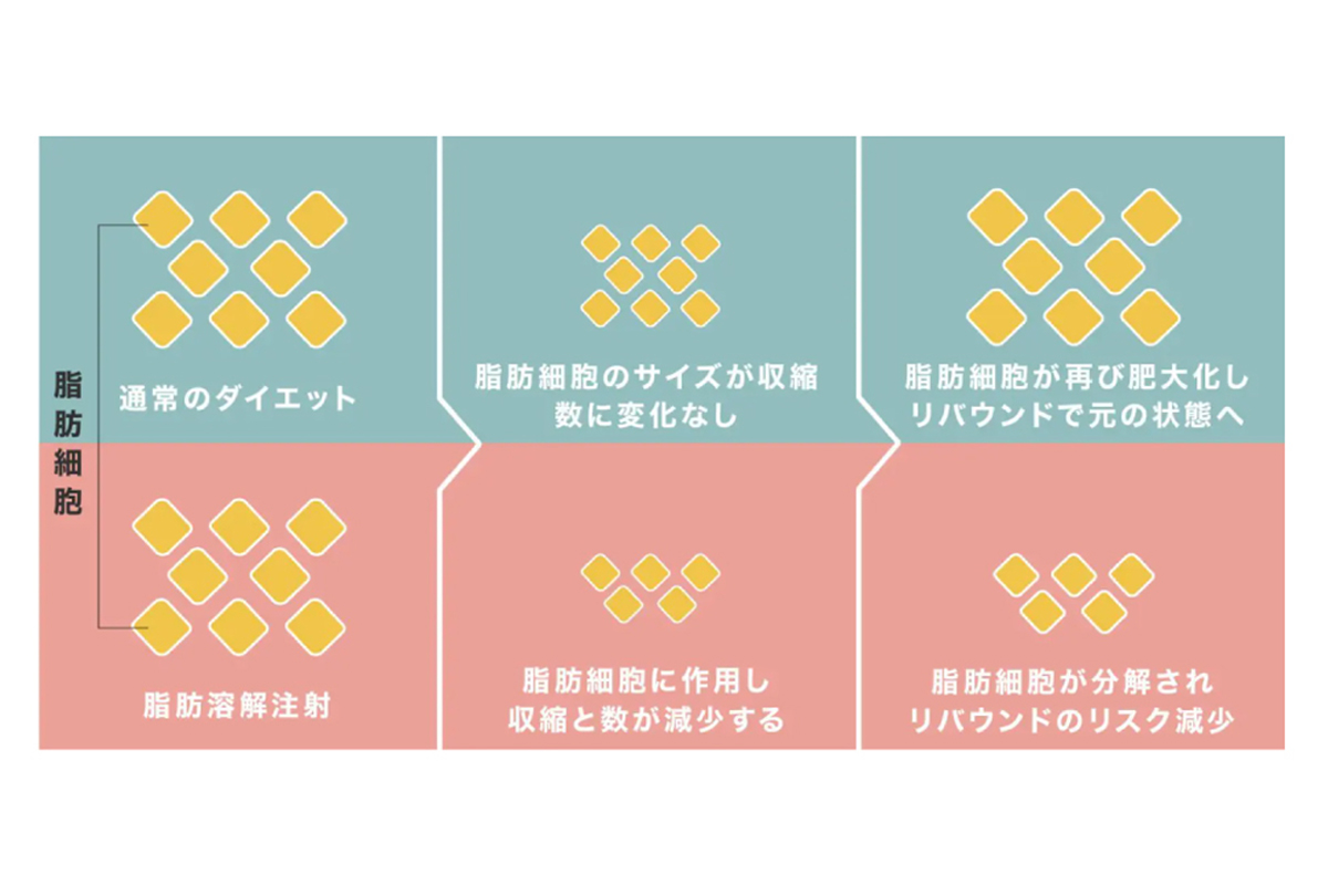 脂肪細胞の変化を比較する図です。上段は「通常のダイエット」で脂肪細胞のサイズは小さくなるものの数は変わらず、再び大きくなってリバウンドしやすい流れが示されています。下段は「脂肪溶解注射」で脂肪細胞に作用して数が減り、分解されることでリバウンドのリスクが減る流れが描かれています。