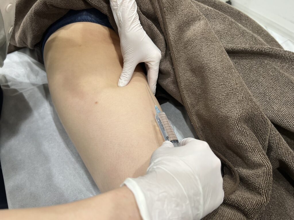 脂肪溶解注射とは?その基本情報