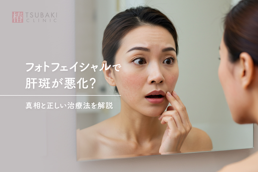 フォトフェイシャルで肝斑が悪化？真相と正しい治療法を解説