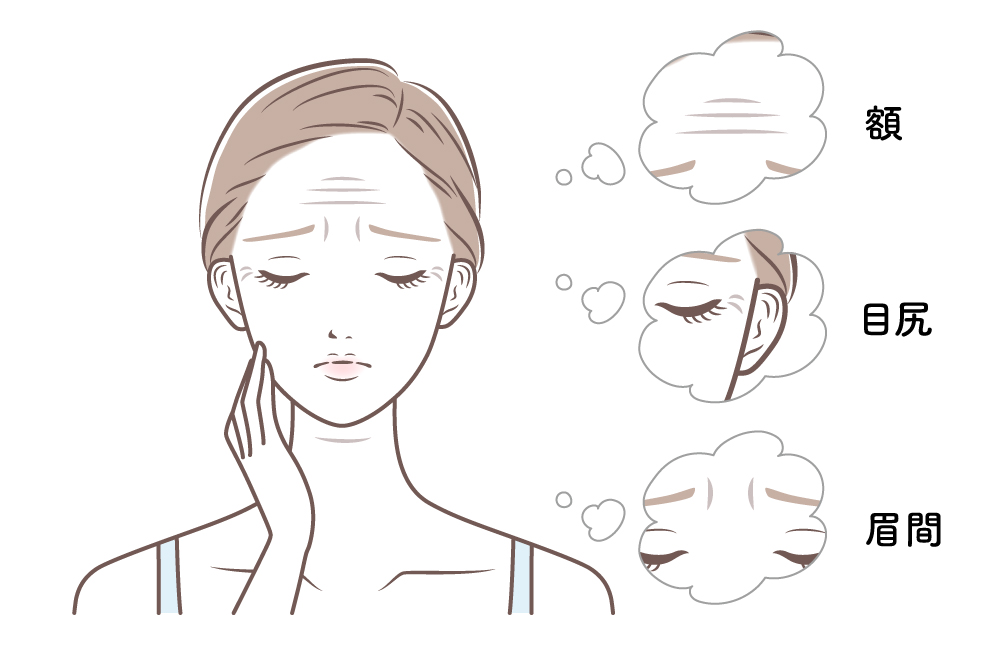 額・目尻・眉間のシワに悩んでいる女性のイラスト