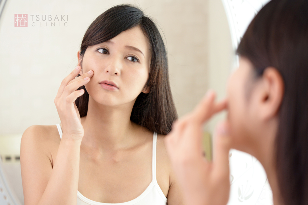 ケミカルピーリングのシミに対する効果を徹底解説