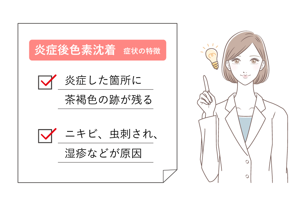 炎症後色素沈着の症状の特徴
