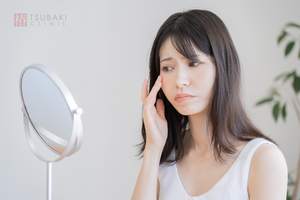 ニキビを繰り返す原因