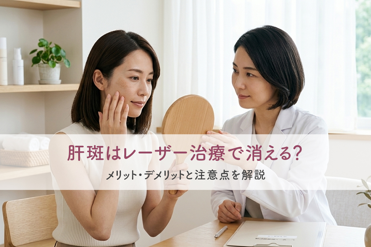 肝斑はレーザー治療で消える？メリット・デメリットと注意点を解説