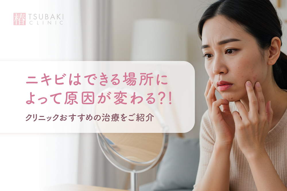 ニキビはできる場所によって原因が変わる？！クリニックおすすめの治療をご紹介