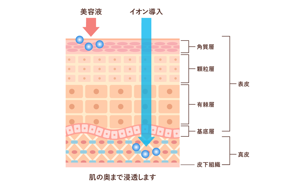 美容液とイオン導入の浸透度の違いを肌の断面図のイラストで示している。美容液は肌の表面の角質層で留まるのに対し、イオン導入は表皮の角質層・顆粒層・有棘層・基底層を通過し真皮にまで到達している様子。