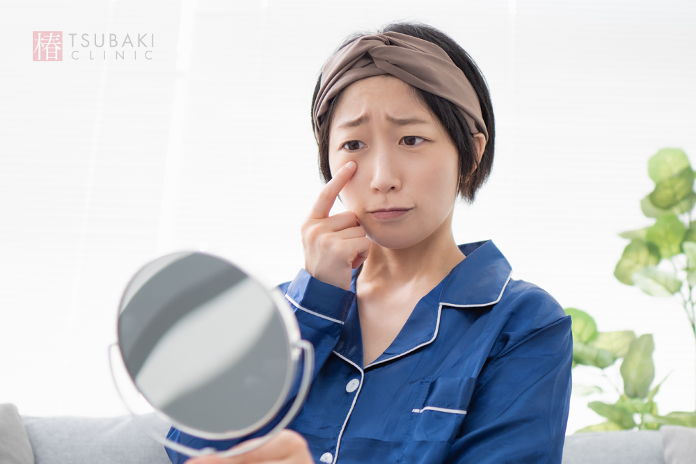 ちりめんじわとは何か？原因と予防法