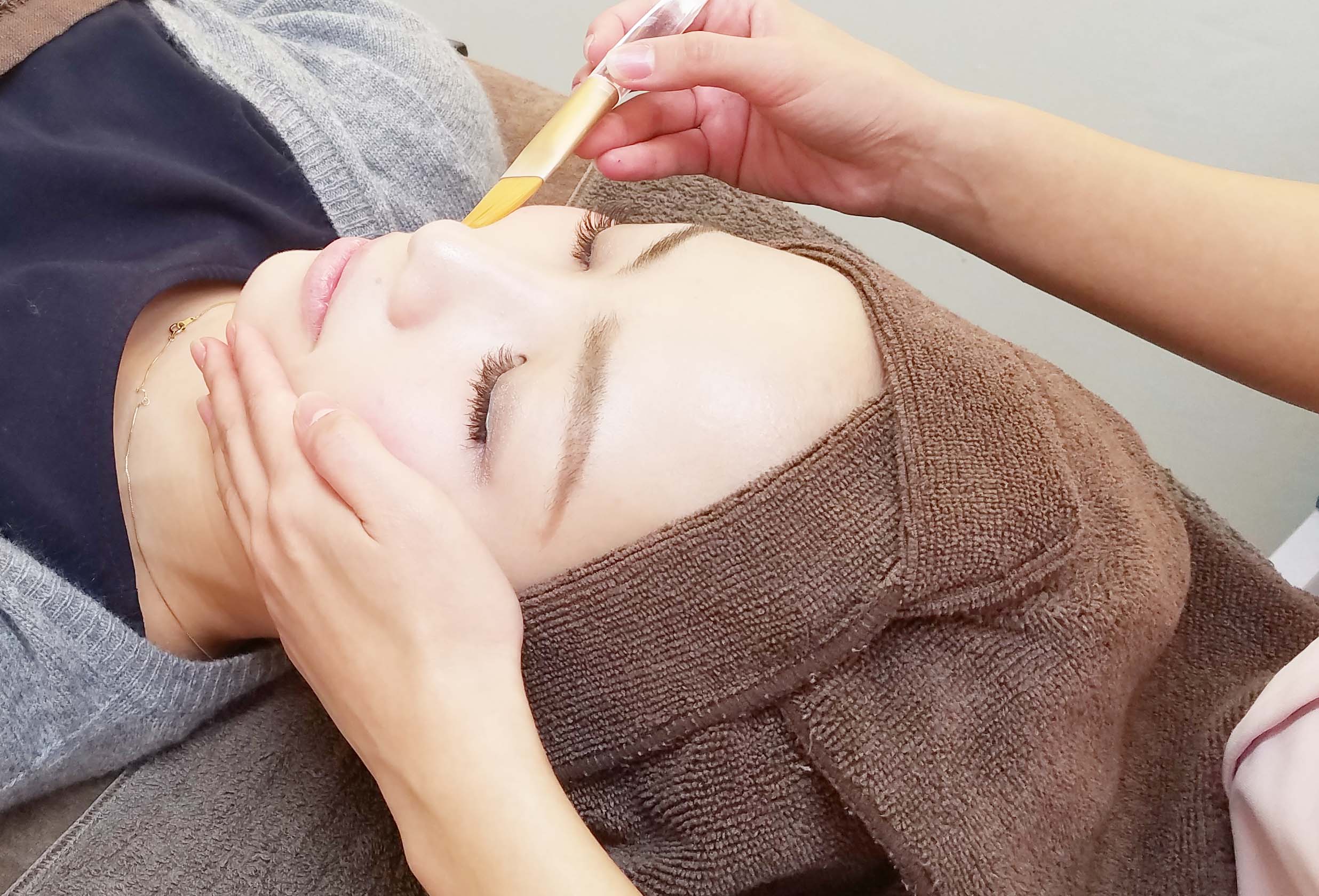 ケミカルピーリング