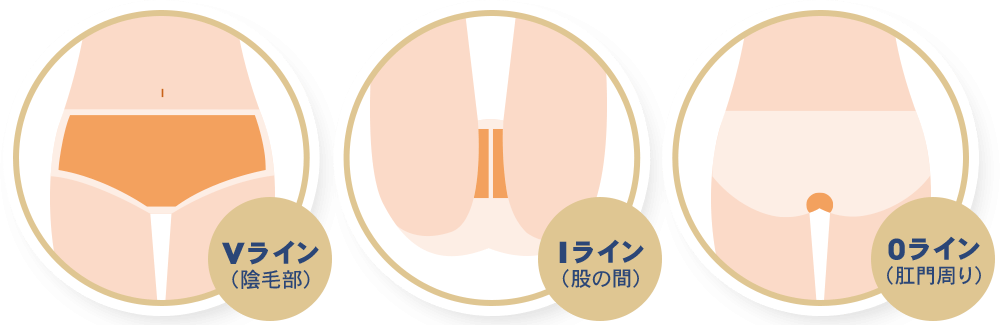脱毛部位