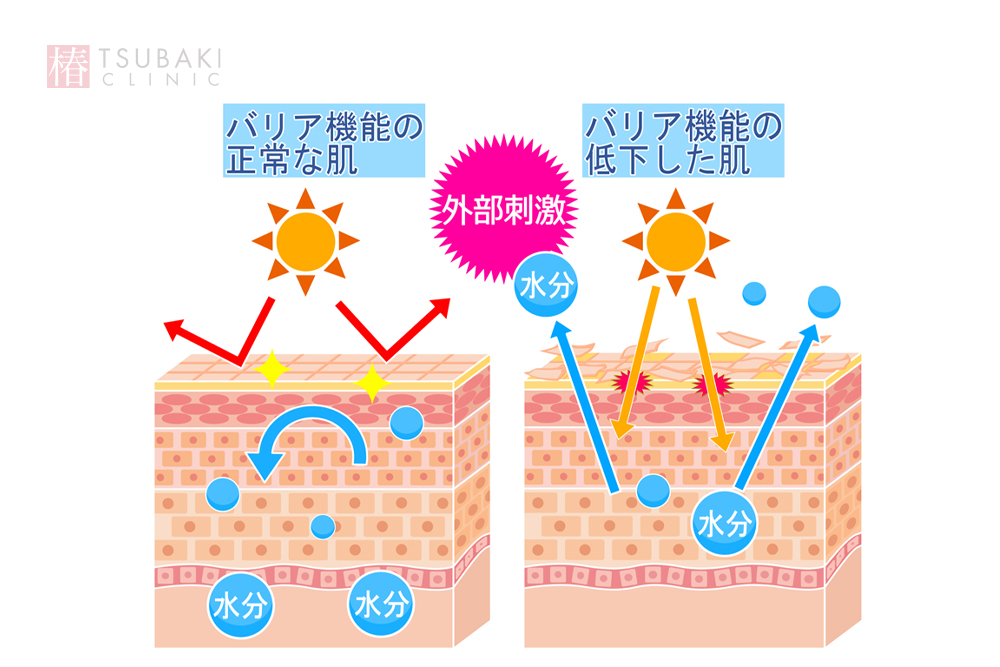 スキンバイブ（ボライトXC）はどこに入れるの？スキンバイブ（ボライトXC）の効果とともに解説します
