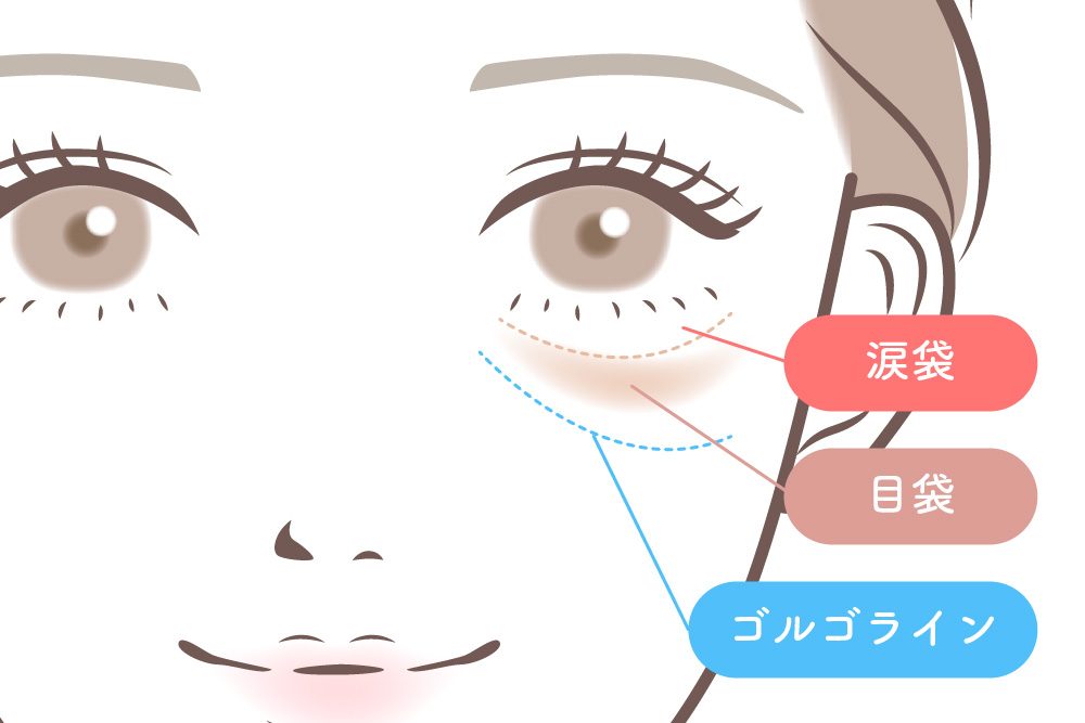 正面を向いた女性の顔のイラスト。目の下に点線で3つの位置を示し、「涙袋」「目袋」に加えて、目袋の下にできる影のラインを「ゴルゴライン」としてラベルで示しています。