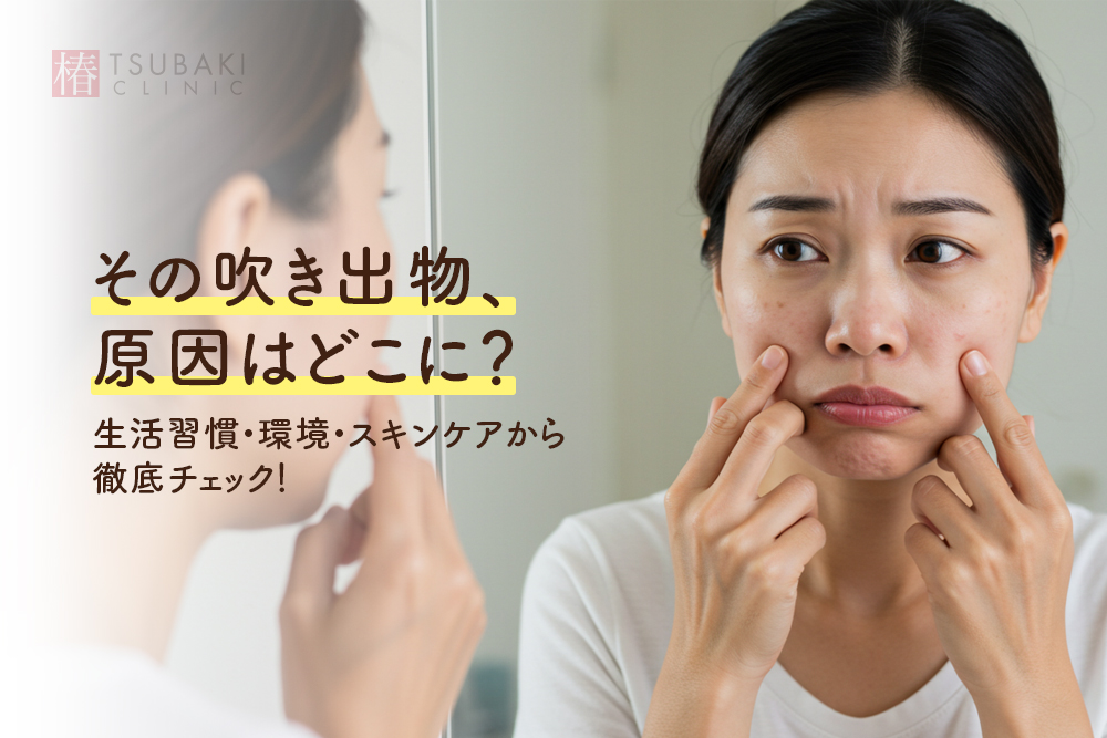 その吹き出物、原因はどこに？生活習慣・環境・スキンケアから徹底チェック！