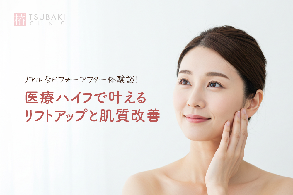 リアルなビフォーアフター体験談！医療ハイフで叶えるリフトアップと肌質改善